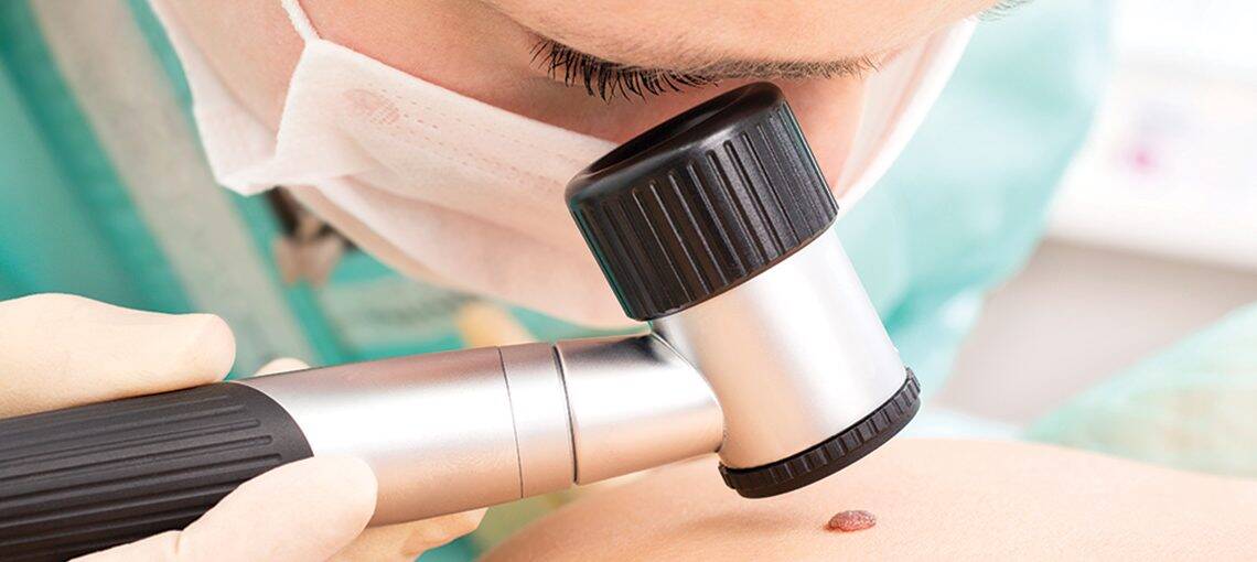 4 Ways Your Donations Are Driving Immunotherapy Advancements 9 4Ways MelanomaImmunotherapy