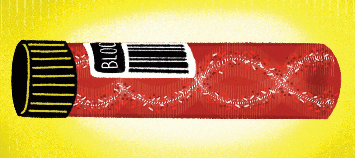 Researchers are Developing Less-invasive Ways to Test for Cancer 10 L Su2018 FrontLine LiquidBenefits