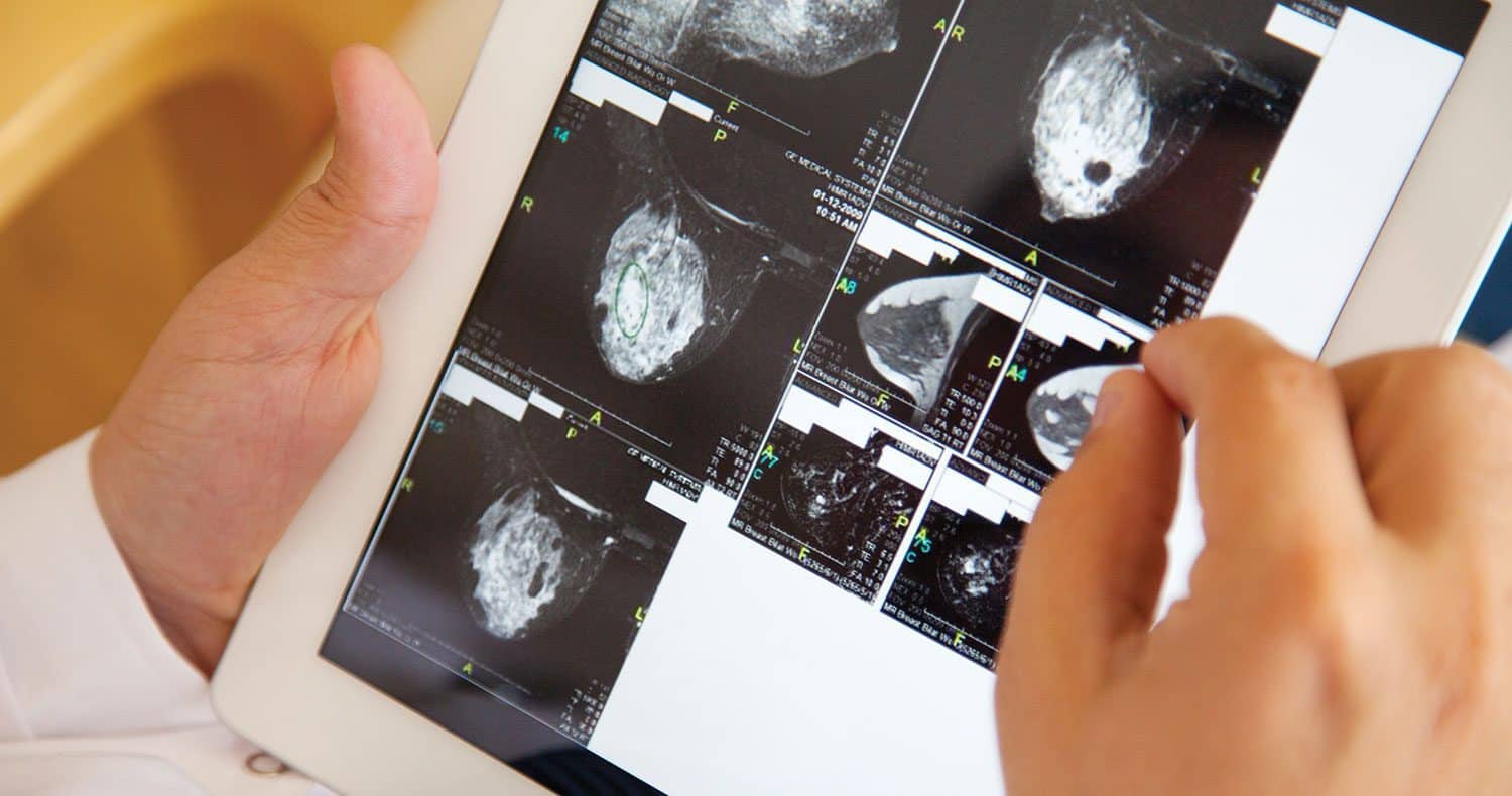 5 Ways Your Donations Are Enhancing Care and Transforming Treatment Options for Women's Cancers 4 LeapSummer2020 5Ways BreastXRay