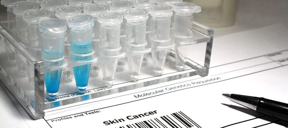 5 Ways Your Donation Has Made An Impact On Cancer Statistics in Alberta 1 Web LeapSp19 5Ways Feature